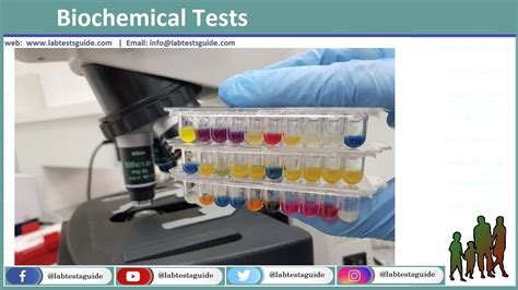 test biochimie|biochemical testing process.